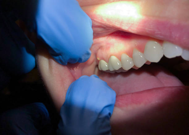 Best Emergency Gum Pain Relief  in Catoosa, OK